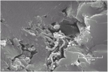 a sem image of in situ microbes in coal