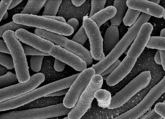 e coli sTJLO 17014