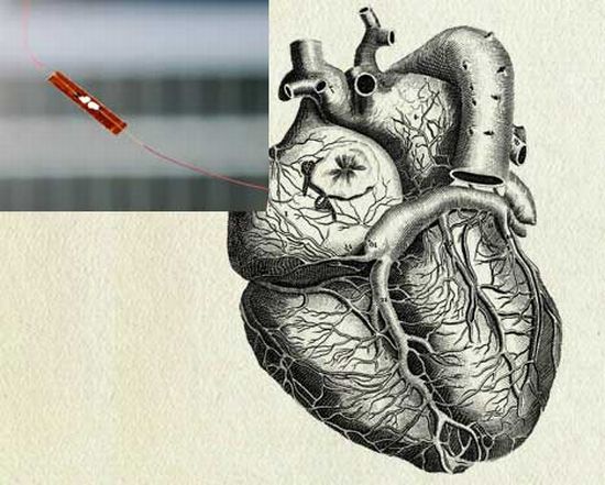 human heart powerd by nanowire generators
