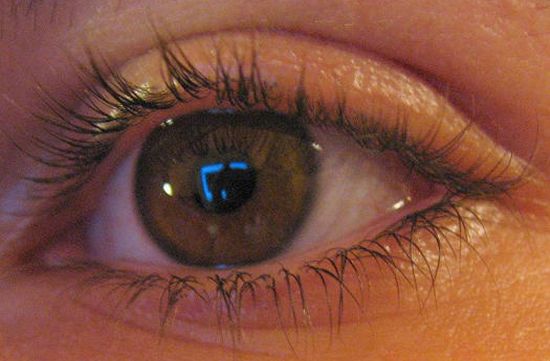 retinal implants 1