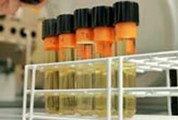 urine powered battery