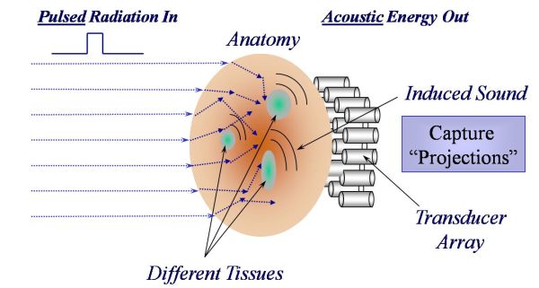 Thermoacoustic_Imaging_Approach