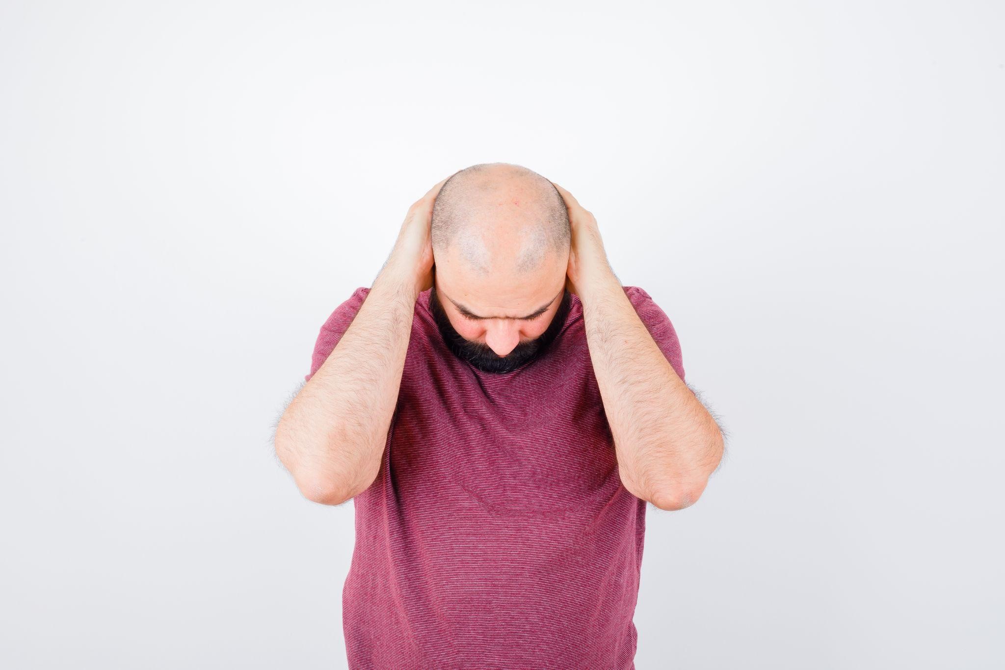 hair loss stages